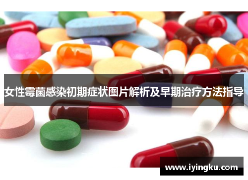 女性霉菌感染初期症状图片解析及早期治疗方法指导